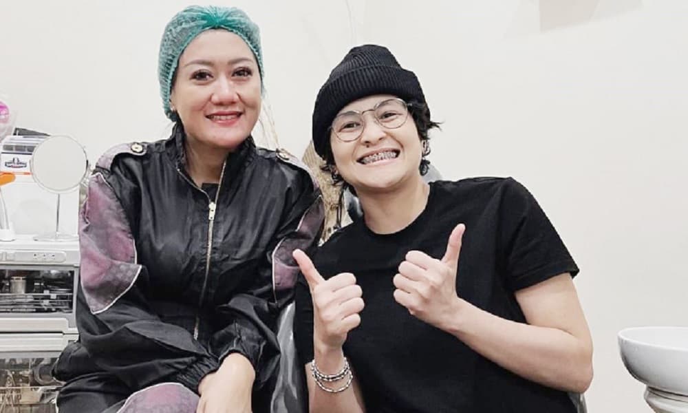 Mita The Virgin Akhirnya Mau Pakai Behel