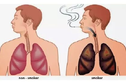 5 Trik Membersihkan Paru-Paru Kotor Karena Efek Rokok